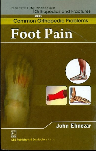 Foot Pain (Handbooks In Orthopedics And Fractures Series Vol 91 Common Orthopedic Problems (2012)