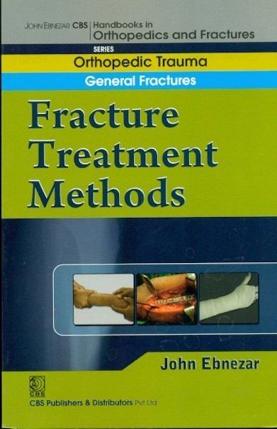 Fracture Treatment Methods (Handbook In Orthopedics And Fractures Vol 02 Orthopedic Trauma General Fractures (2012)
