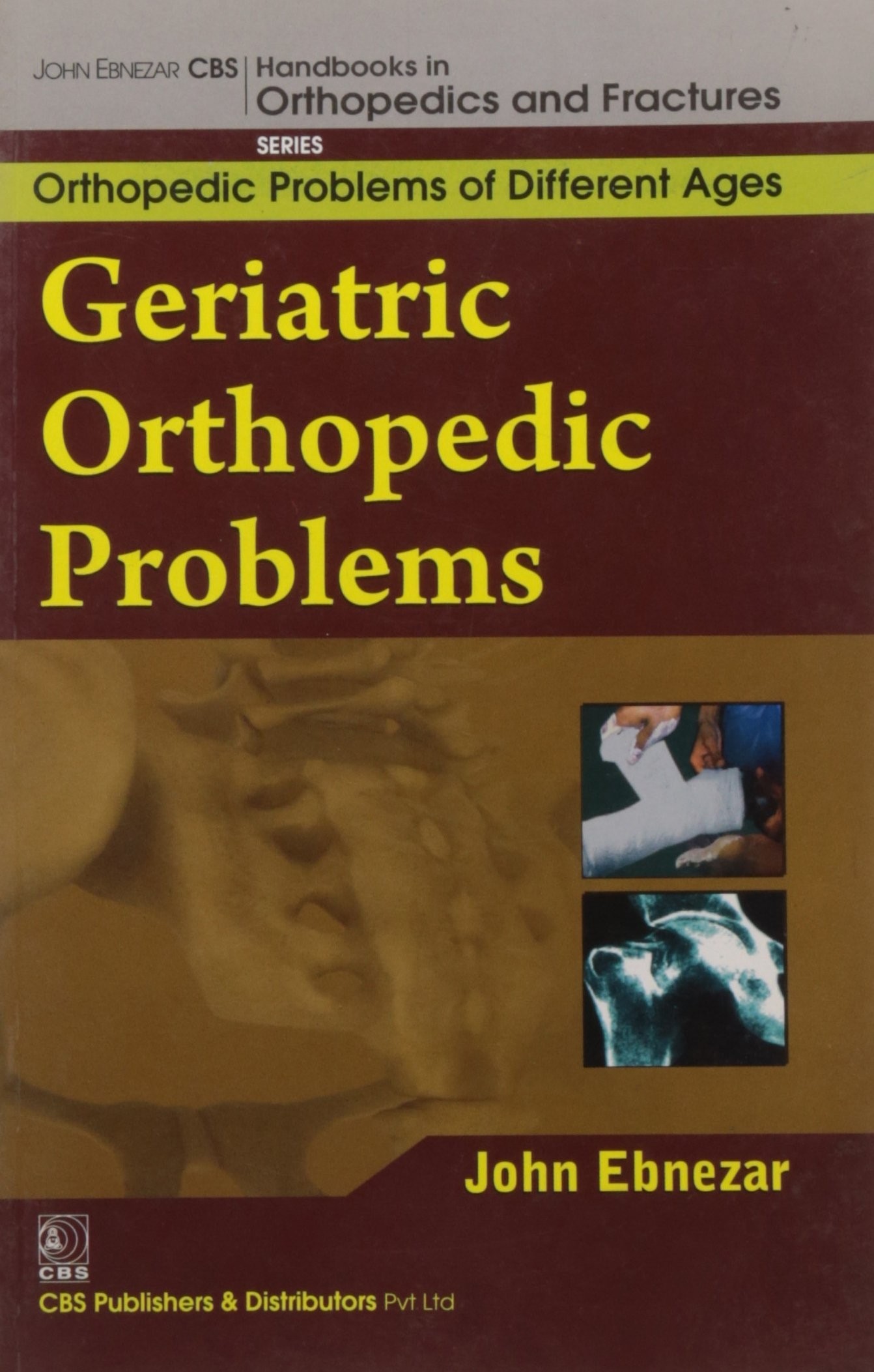 Geriatric Orthopedic Problems (Handbooks In Orthopedics And Fractures Series Vol 78 Orthopedic Problems Of Differnet Ages (2012)