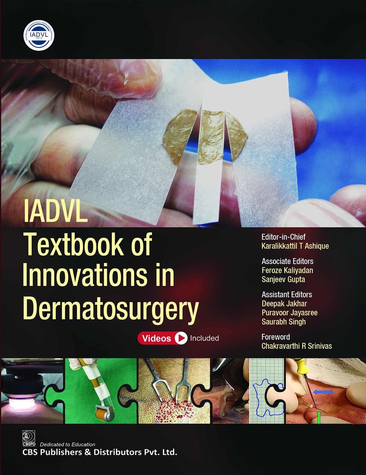Iadvl Textbook Of Innovations In Dermatosurgery (Hb 2022)
