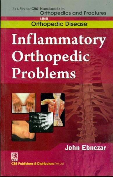 Inflammatory Orthopedic Problems (Handbooks In Orthopedics And Fractures Series Vol 34 Orthopedic Disease (2012)
