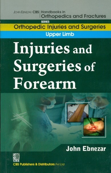 Injuries And Surgeries Of Forearm (Handbooks In Orthopedics And Fractures Series Vol 53 Orthopedic Injuries And Surgeries Of Forearm (2012)
