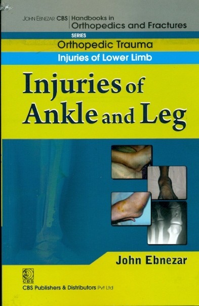 Injuries Of Ankle And Leg (Handbook Of Orthopedics And Fratures Series Vol 17 Orthopedic Trauma Injuries Of Lower Limb (2012)