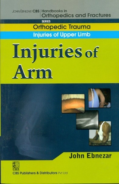 Injuries Of Arm ((Handbook In Orthopedics And Fractures Series Vol 6 Orthopedic Trauma Injuries Of Upper Limb (2012)