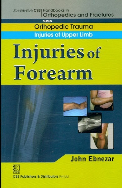 Injuries Of Forearm (Handbook In Orthopedics And Fractures Series Vol 8 Orthopedic Trauma Injuries Of Upper Limb (2012)