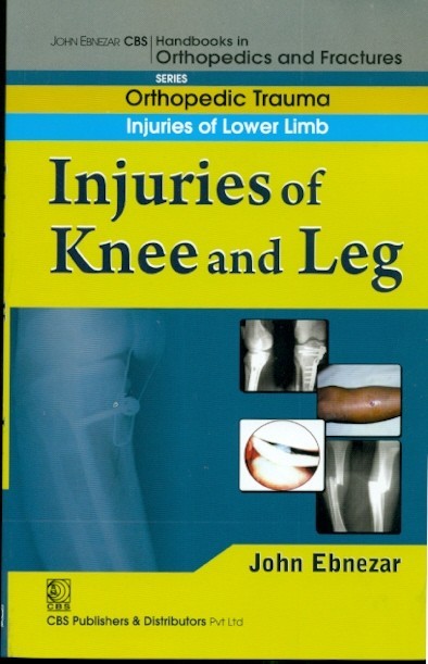 Injuries Of Knee And Leg (Handbook In Orthopedics And Fractures Series Vol 16 Orthopedic Trauma Injuries Of Lower Limb (2012)
