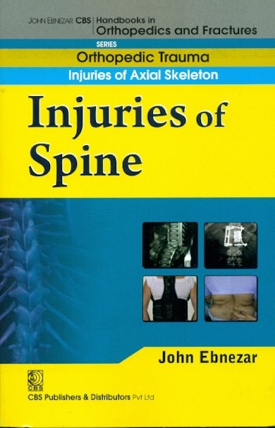 Injuries Of Spine (Handbook Of Orthopedics And Fractures Series Vol 21 Orthopedic Trauma Injuries Of Axial Skeleton (2012)