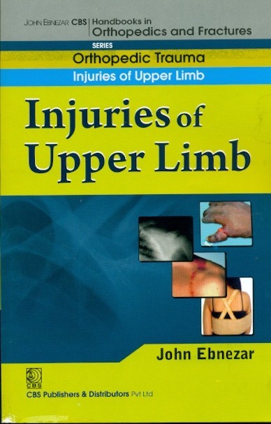Injuries Of Upper Limb ((Handbook In Orthopedics And Fractures Vol 12 Orthopedic Trauma Injuries Of Upper Limb (2012)