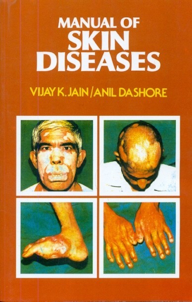 Manual Of Skin Diseases (Pb 2022) 