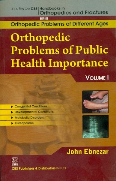 Orthopedic Problems Of Public Health Importance (Handbooks Of Orthopedics And Fractures Series 1 Vol 82 Orthopedic Problems Of Different Ages (2012)