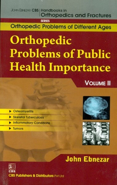 Orthopedic Problems Of Public Health Importance 11 (Handbooks In Orthopedics And Fractures Series Vol 83 Orthopedic Problems Of Different Ages (2012)