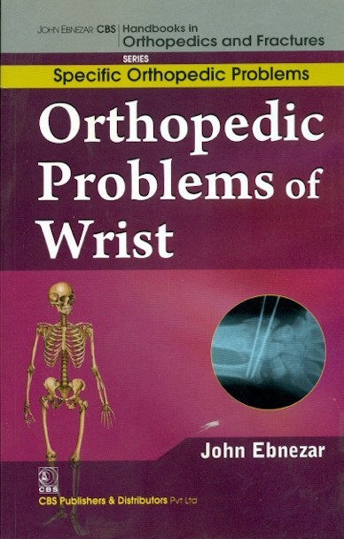 Orthopedic Problems Of Wrist (Handbooks In Orthopedics And Fractures Series Vol 46 Specific Orthopedic Problems (2012)