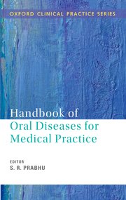HANDBOOK OF ORAL DISEASES